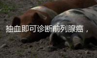 抽血即可诊断前列腺癌�，拜登为何不测
？