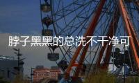 脖子黑黑的总洗不干净可能是病了
，这些疾病信号赶紧自查